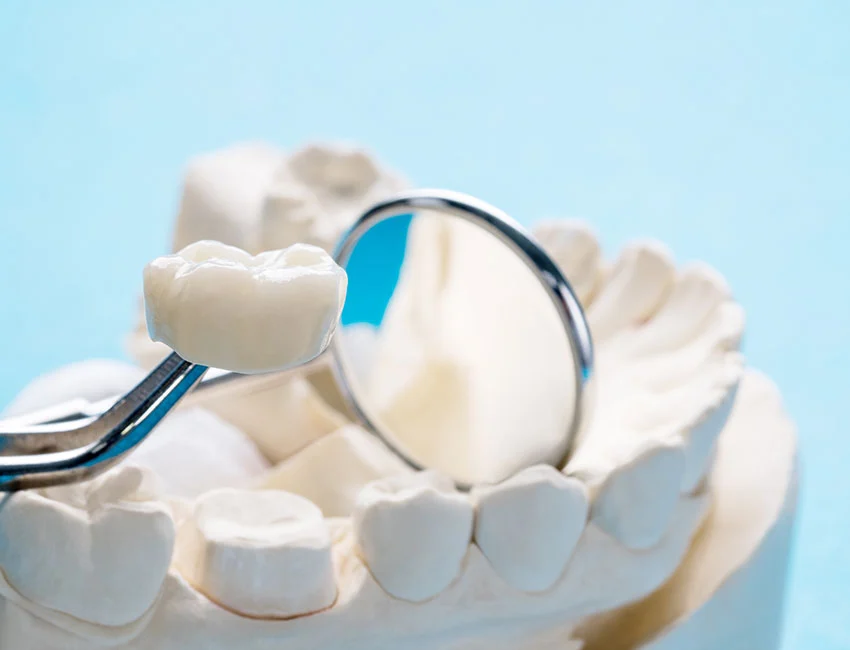 What is Dental Crowns
