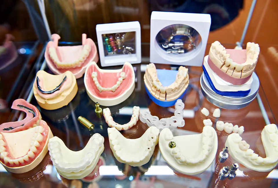 Dental Implants Cost — The Complete Guide