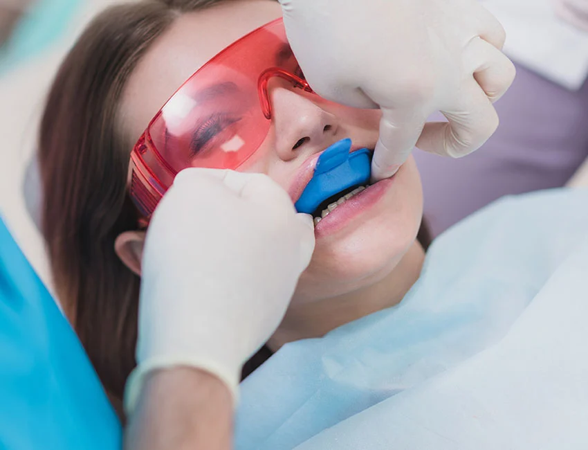What is Fluoride Treatments