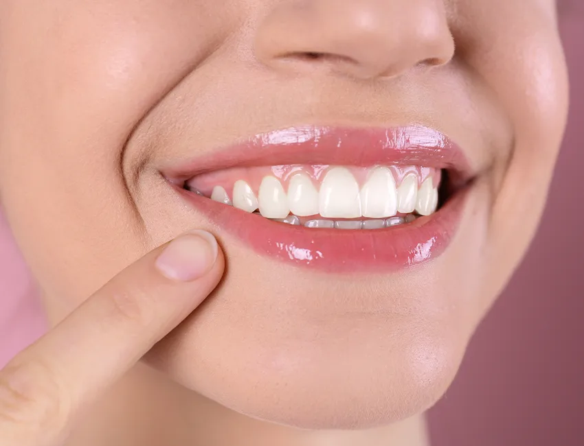 What is Gum Contouring