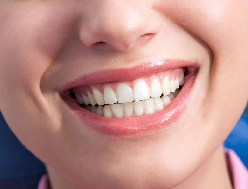 What is Crown Lengthening Procedure (CLP)