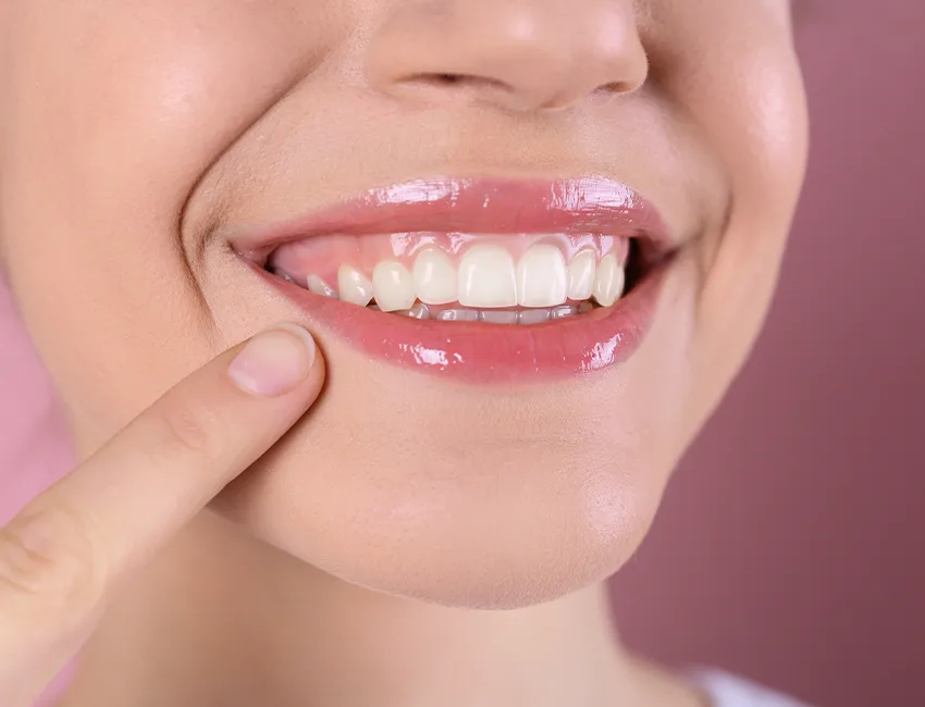 What is Gingivectomy (Gummy Smile)
