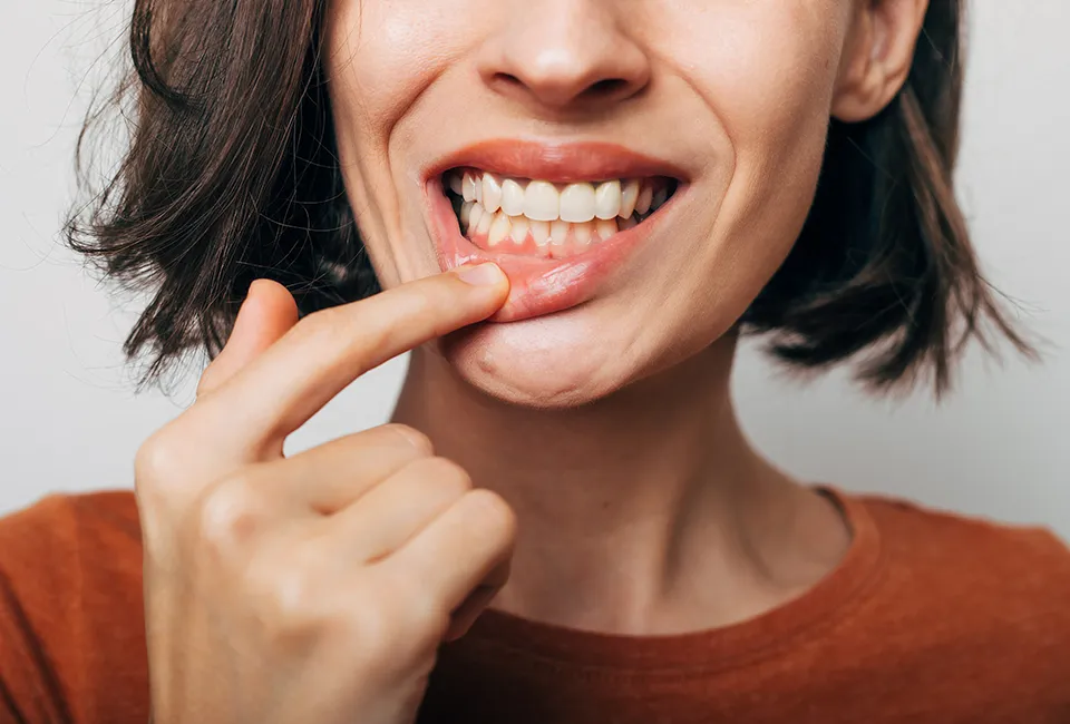 Signs of Unhealthy Gums and How to Treat Them