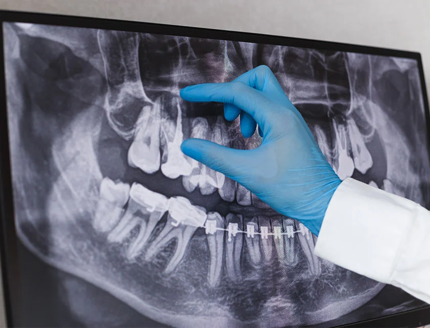 What is endodontics