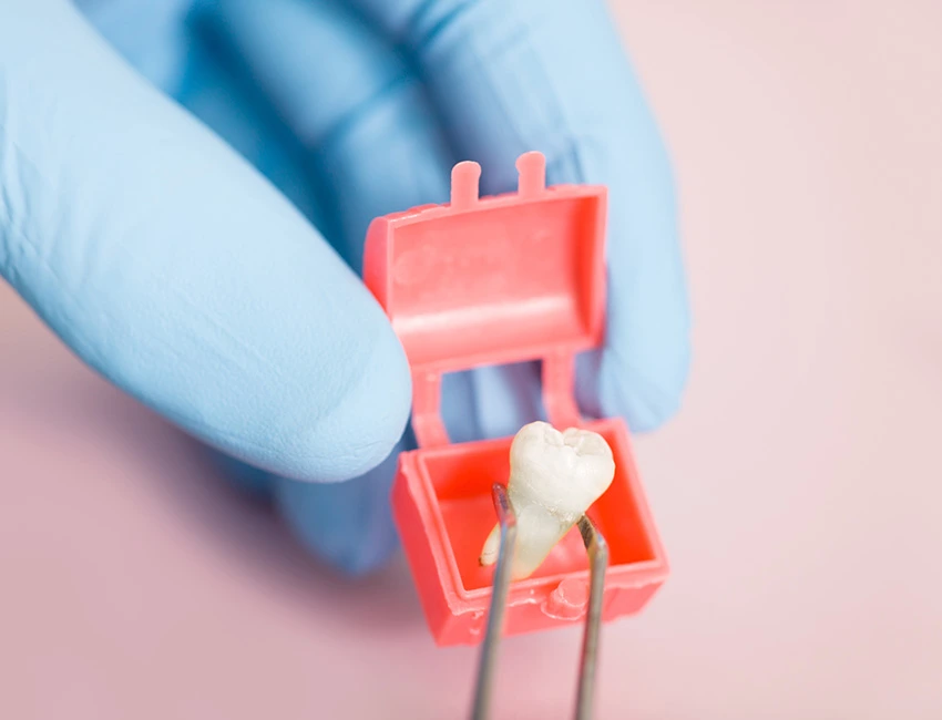 What is Wisdom Teeth Removal